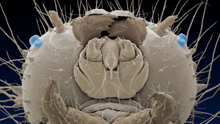 Head of the caterpillar of the map (Araschnia levana), coloured scanning electron micrograph.